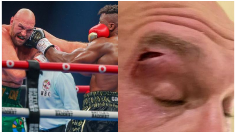 Tyson Fury v Oleksandr Usyk undisputed heavyweight title fight off after Briton sustains cut following a deep eye injury sustained by tyson fury making him lose his eye to total darkness