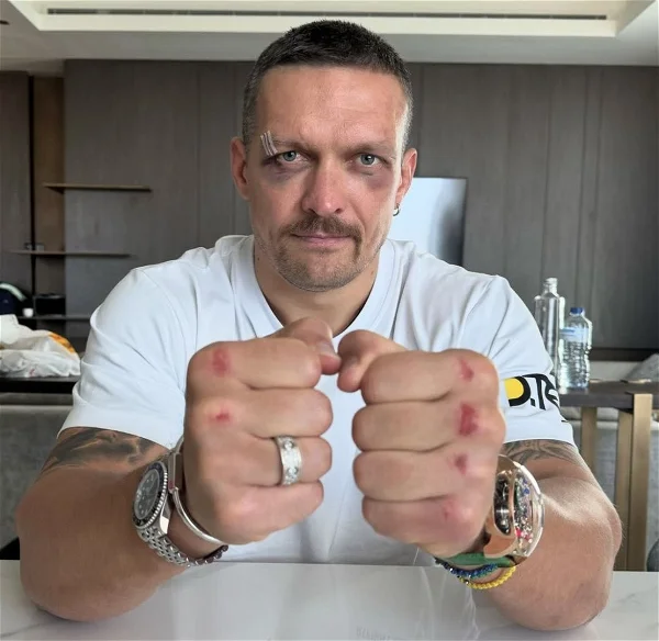 “If You Stop He’ll Kill You”: Oleksandr Usyk Admits Being Hurt by Tyson Fury